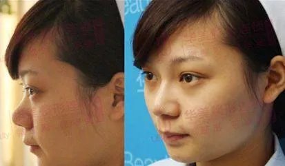 华东医药怎么样？值得长期(十年以上)投资吗？