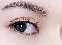 全切双眼皮手术是什么意思