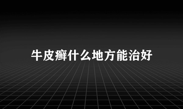 牛皮癣什么地方能治好