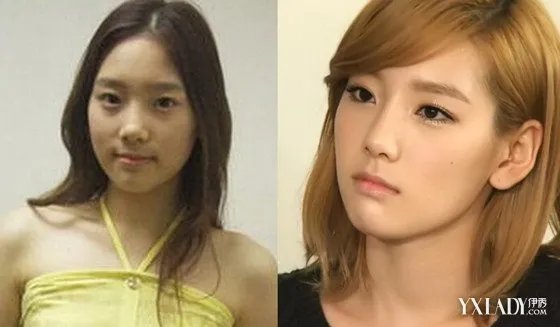 金泰妍整容前后差别大韩国女星对比照超惊人