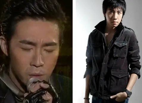 曝俞灏明烧伤前后对比照片 素颜归来拍感人记录片