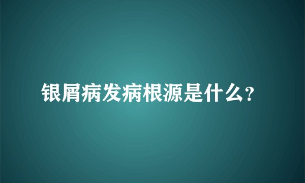 银屑病发病根源是什么？