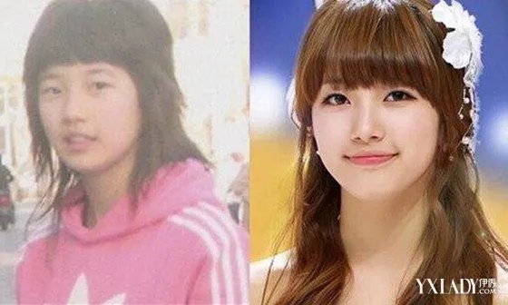 金泰妍整容前后差别大韩国女星对比照超惊人