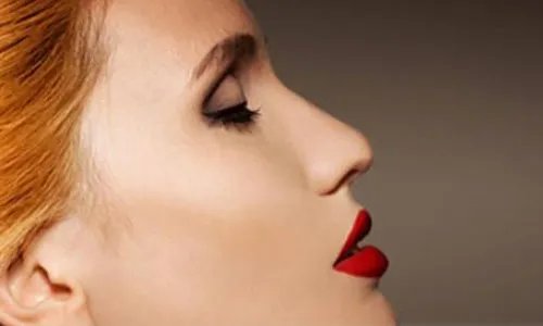 激光治疗酒渣鼻效果好吗