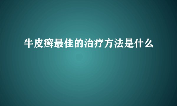牛皮癣最佳的治疗方法是什么