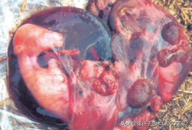 兰州兽研所布病事件，致附近3000多居民染病，感染布鲁氏菌对人体健康影响有多大？那些感染布病的居民现状如何？