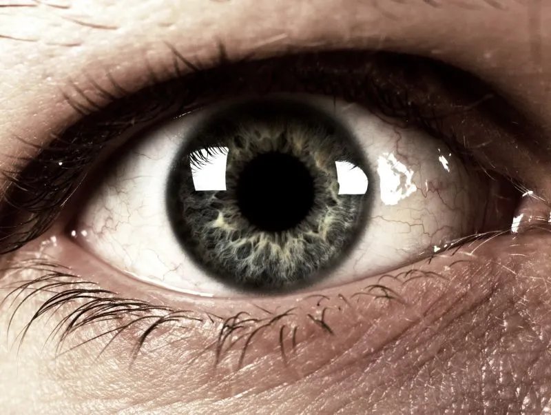 眼角纹怎样去除