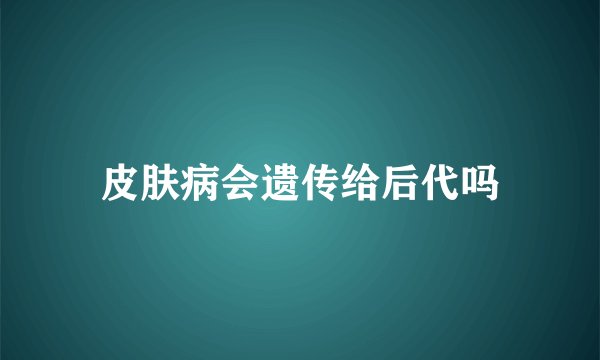 皮肤病会遗传给后代吗