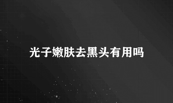 光子嫩肤去黑头有用吗