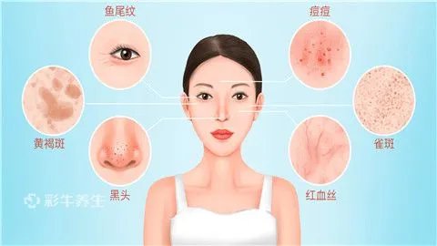 氨甲环酸能去黄褐斑吗