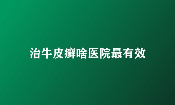 治牛皮癣啥医院最有效