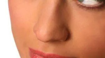 假体隆鼻术后效果自然吗