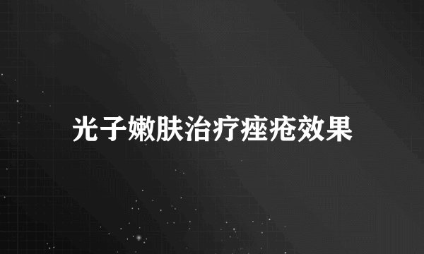 光子嫩肤治疗痤疮效果