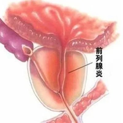 男性可以吃什么补精