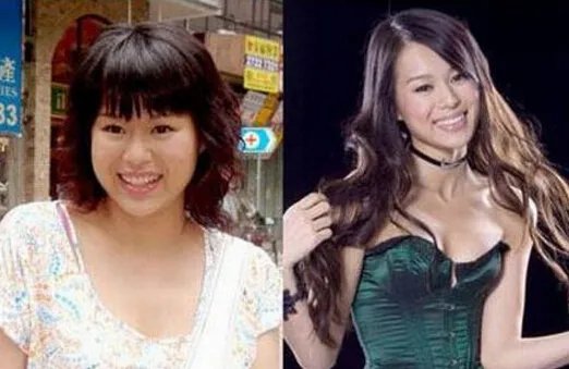 胡杏儿整容前后对比照  圆脸消瘦变尖下巴变化惊人