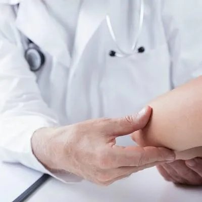 如何治疗手部湿疹