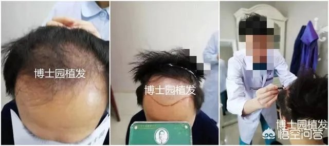 关于「男生自己吹头发技巧」，问问大家怎么看？