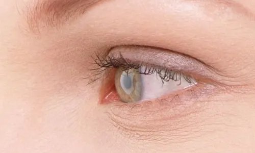 眼部抽脂手术要多少费用