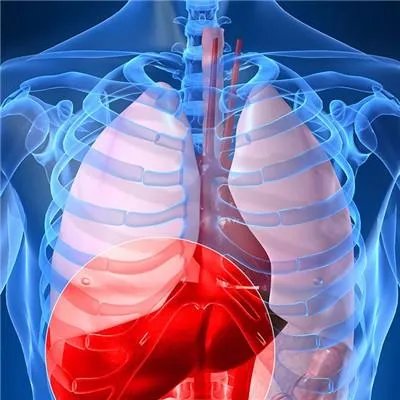 肝硬化腹水能治吗