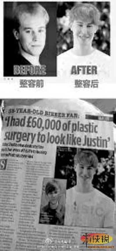 男粉丝整容成比伯 盘点那些下了血本的追星族们