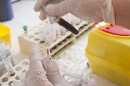 麻醉师是做什么的 具体工作情况有哪些