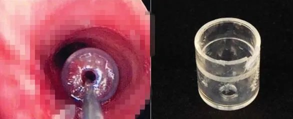 为什么笔盖上的孔又叫“救命孔”？