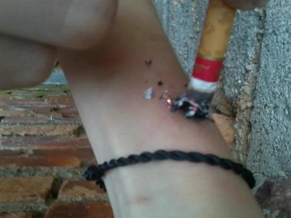 我想要几张自残的照片 不要ck的什么红人的 就是普通自己照的那种就行