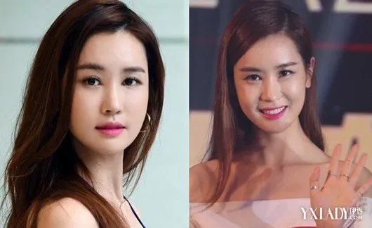 李多海再次变脸整容前后照片遭热搜