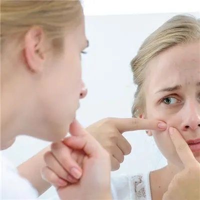 怎么去痘印最快