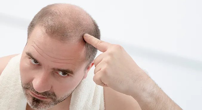 掉头发很厉害怎么办