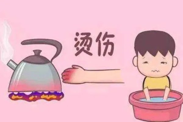 河北一女孩玩火碱重度烧伤，不小心烧伤第一时间该如何处理伤口？