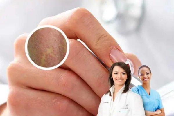 可善挺需要一直注射吗