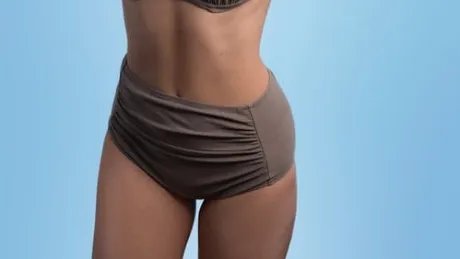 消除妊娠纹的方法有哪些