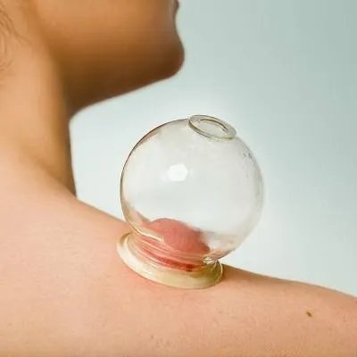 多囊卵巢的治疗方式