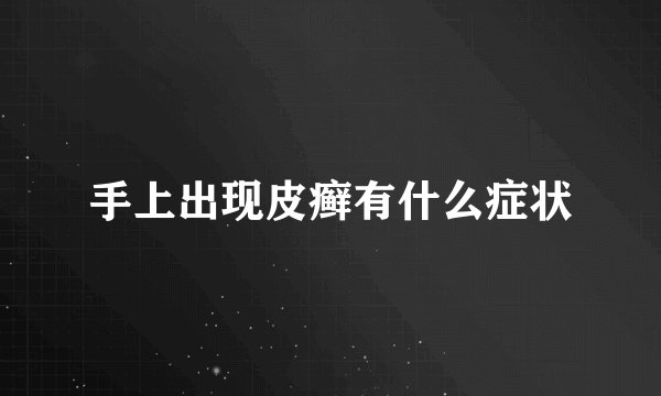 手上出现皮癣有什么症状