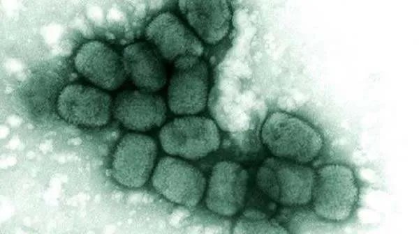 猴痘病毒长什么模样？它有多可怕？