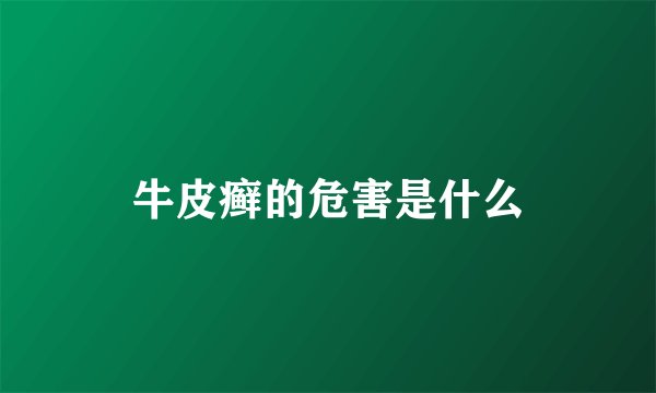 牛皮癣的危害是什么