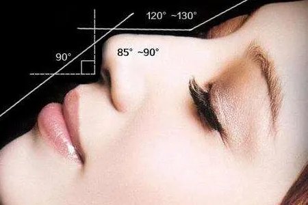 假体隆鼻术后注意事项